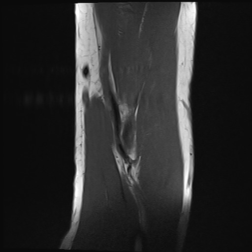 Click on the Serie image to view the images of Wieszt, Gnter